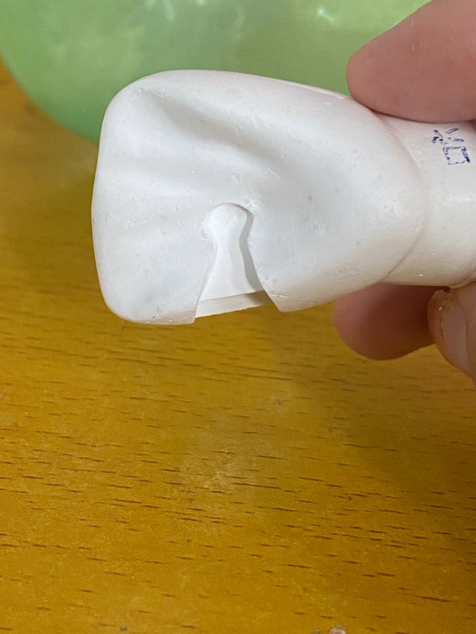 口腔医学日常|三类洞备牙 三类洞