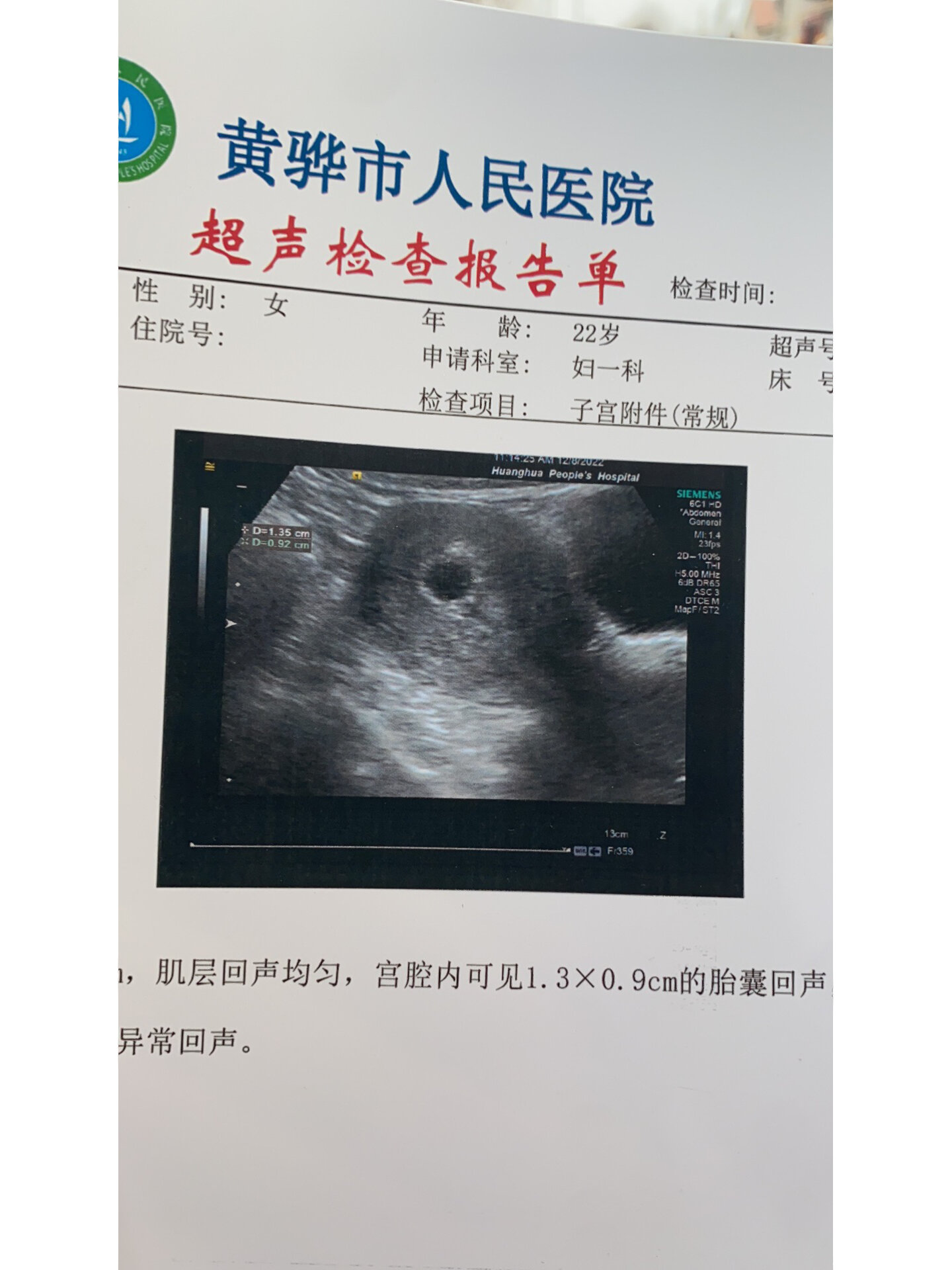 听说孕囊是圆的就是女孩 听说孕囊是圆的就是女孩,是不是真的到底