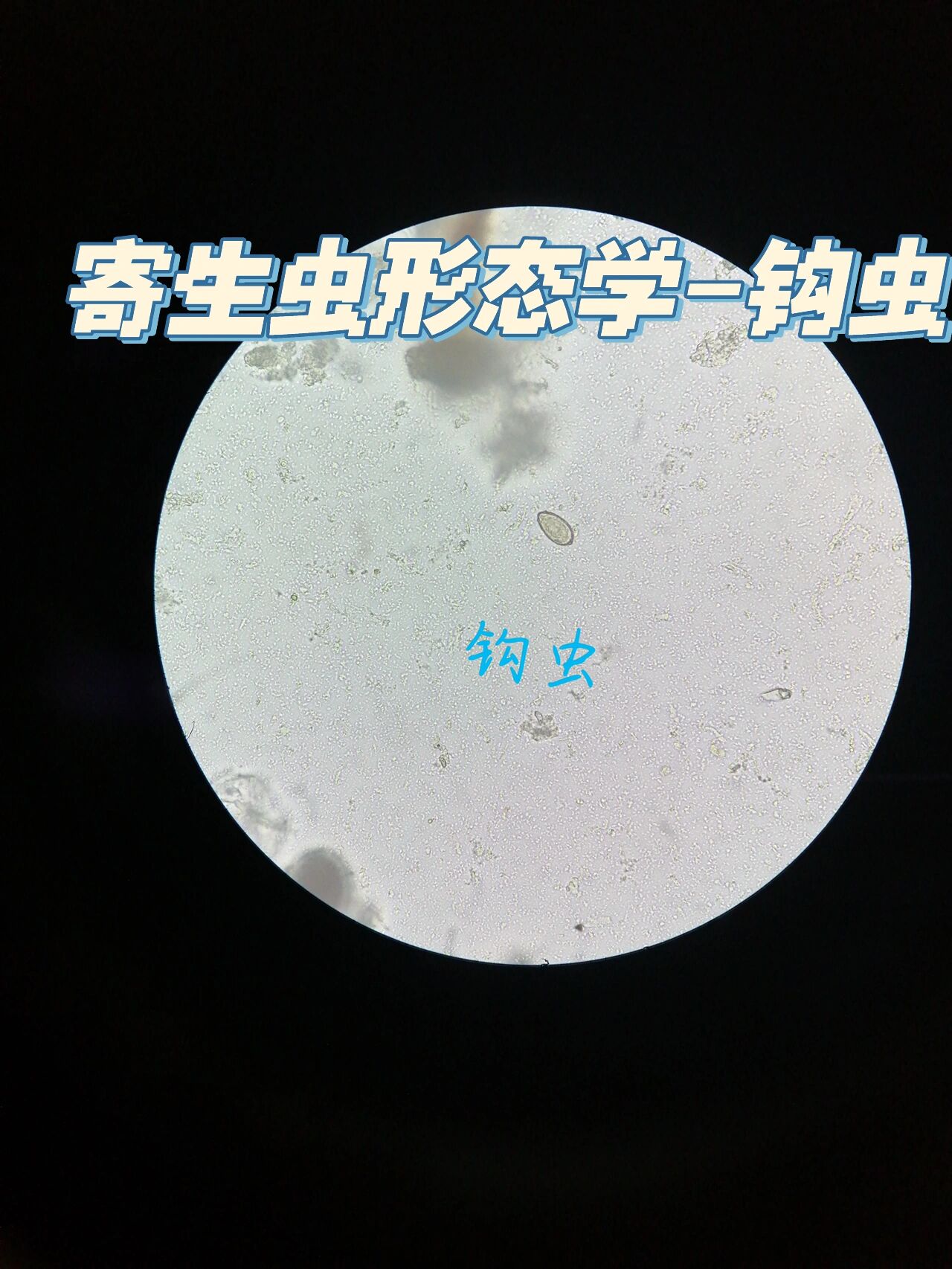寄生虫形态学-钩虫 寄生虫形态学-钩虫卵 椭圆形,大小约57-76×36-40