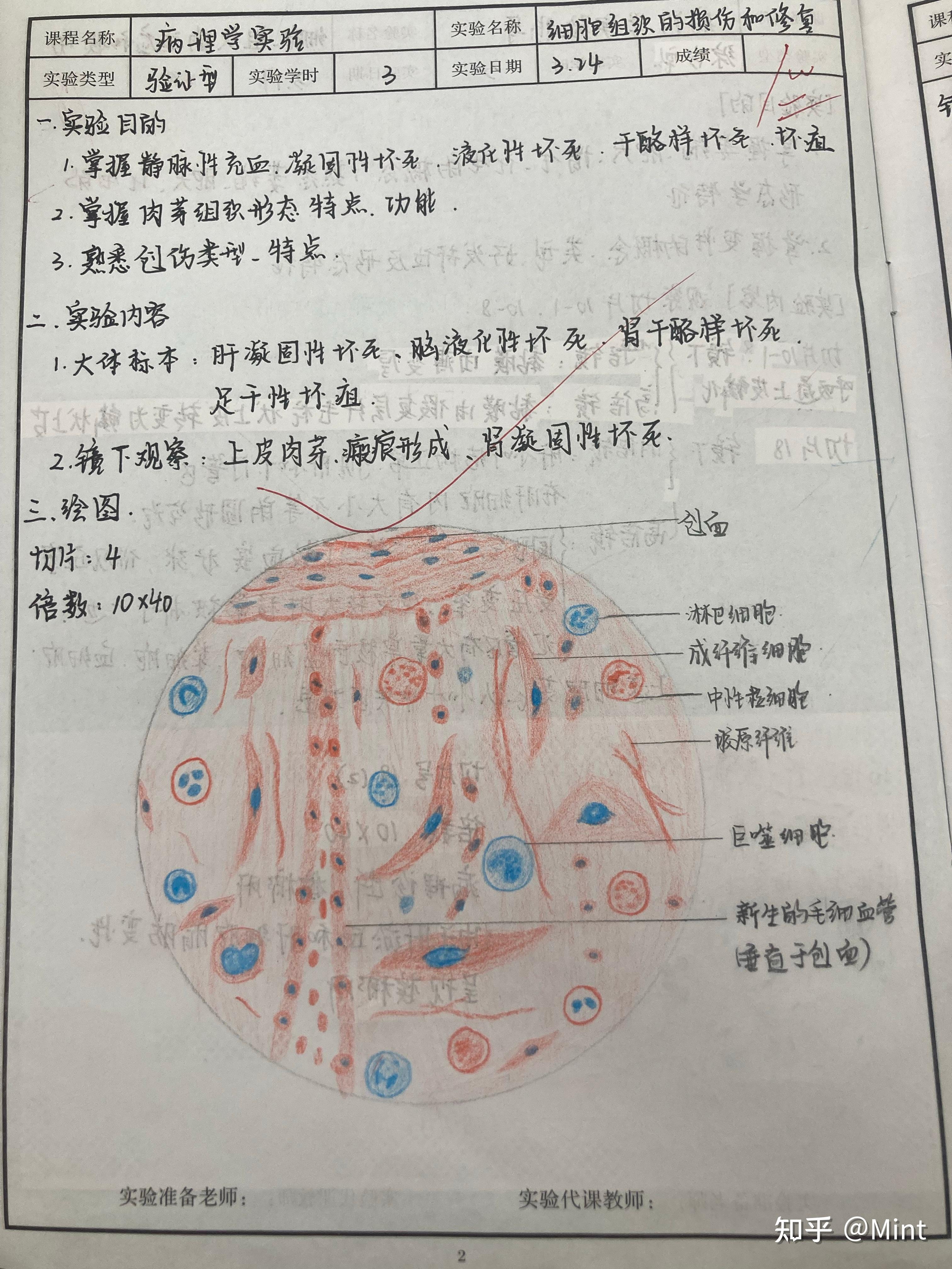 乙脑病理红蓝铅笔图图片