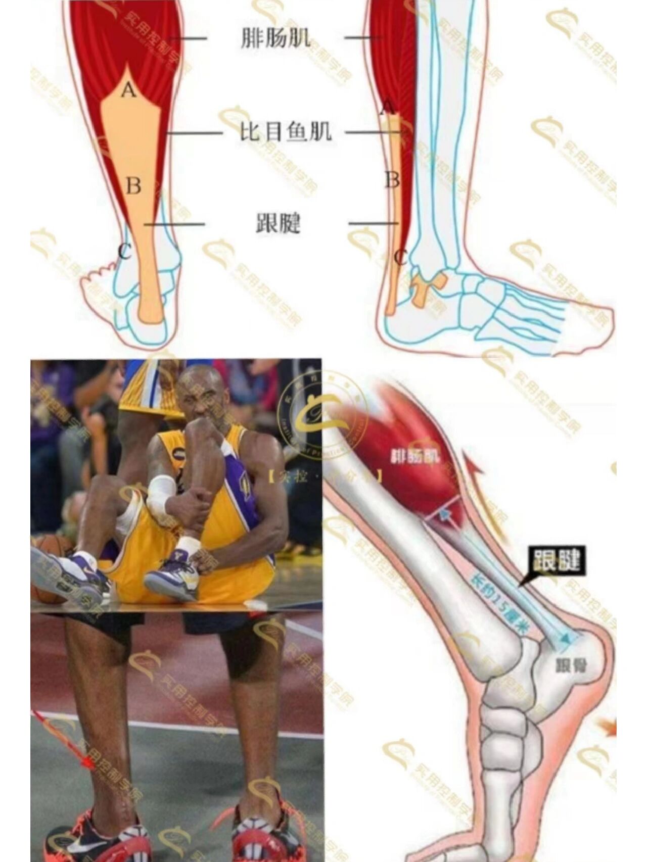 怎样测量跟腱长度图解图片