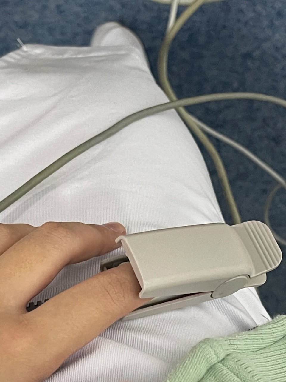心电监护仪 死亡