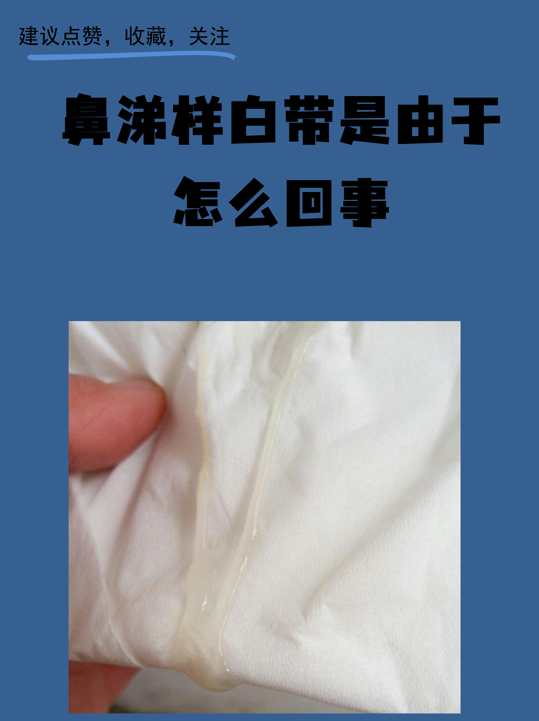 鼻涕样白带是由于怎么回事