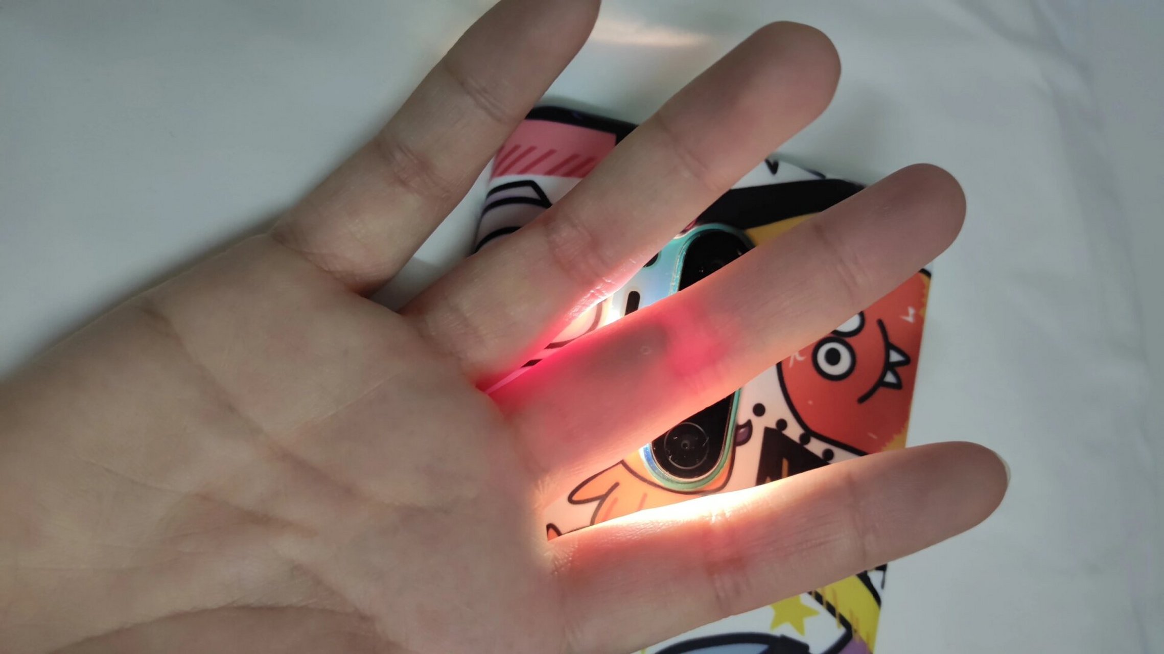 这是手指里面的血管爆了吗 怎么可以这么好笑玩闹过程中手拍到了手机