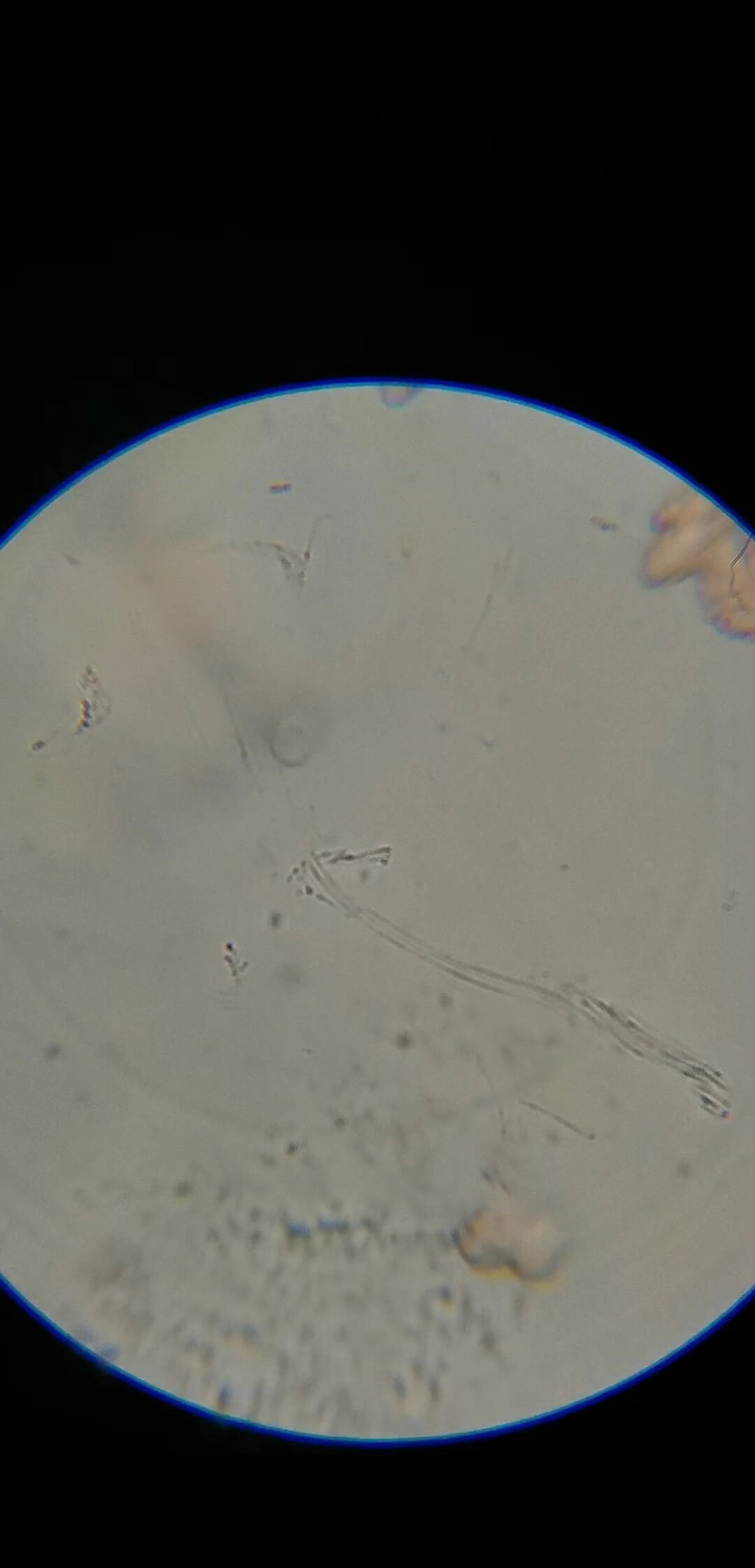 红细胞吸水涨破