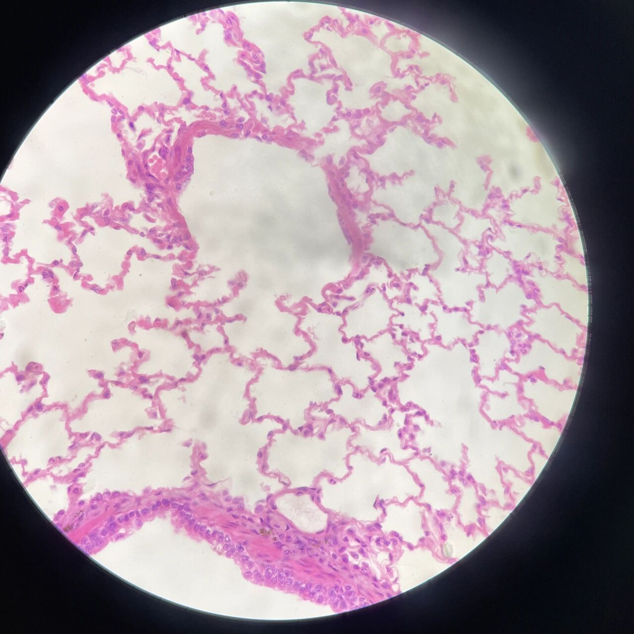 组胚绘图12-肺组织(呼吸部)