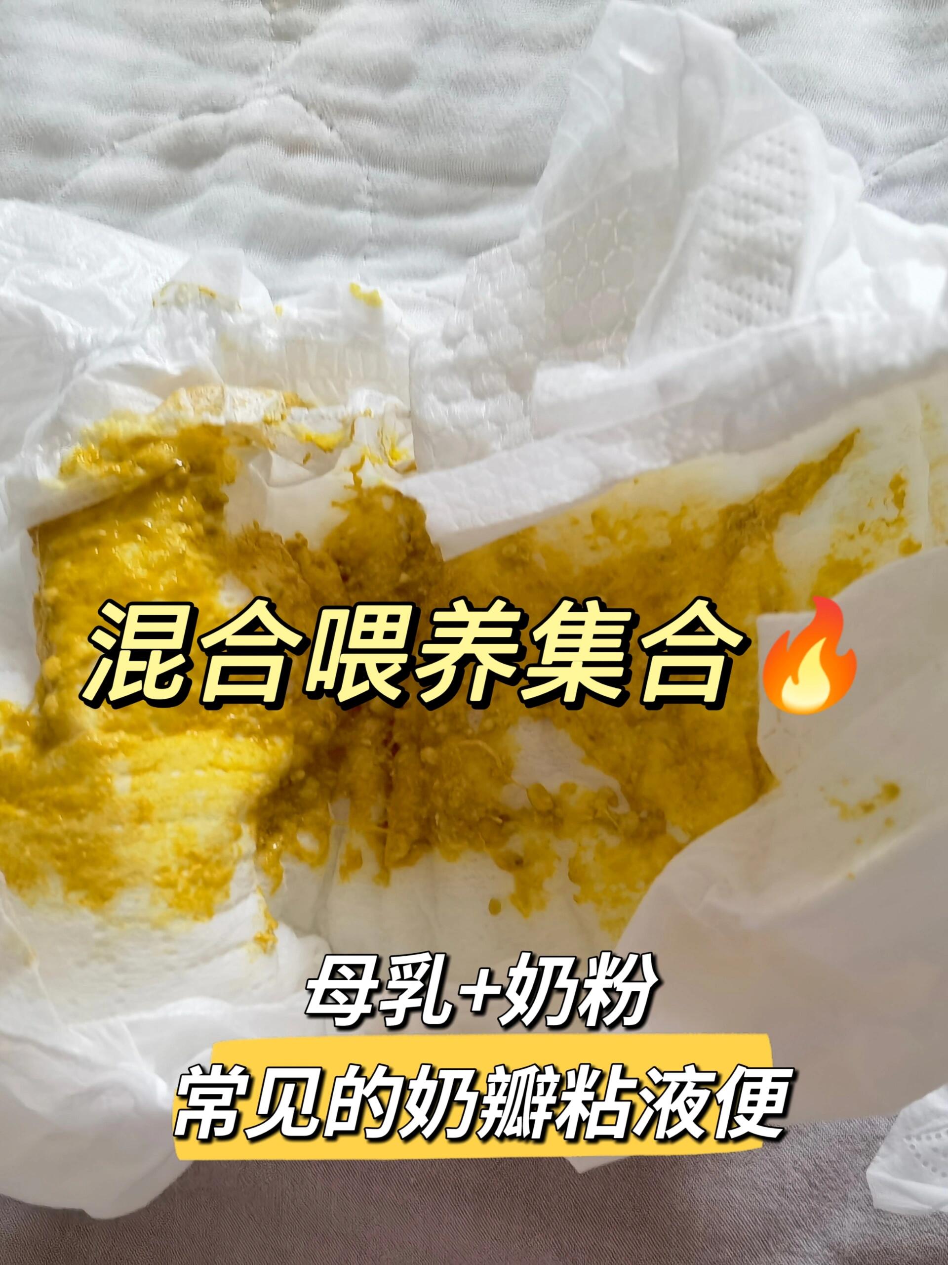 混合喂养奶瓣粘液如何调理?