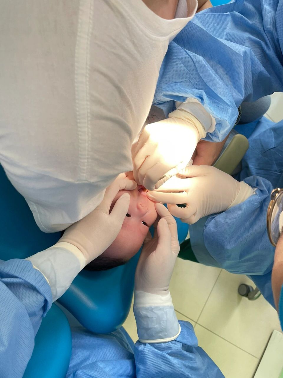 关于小月龄宝宝剪舌系带~ 月子里就发现我女儿的舌尖有点不一样 伸