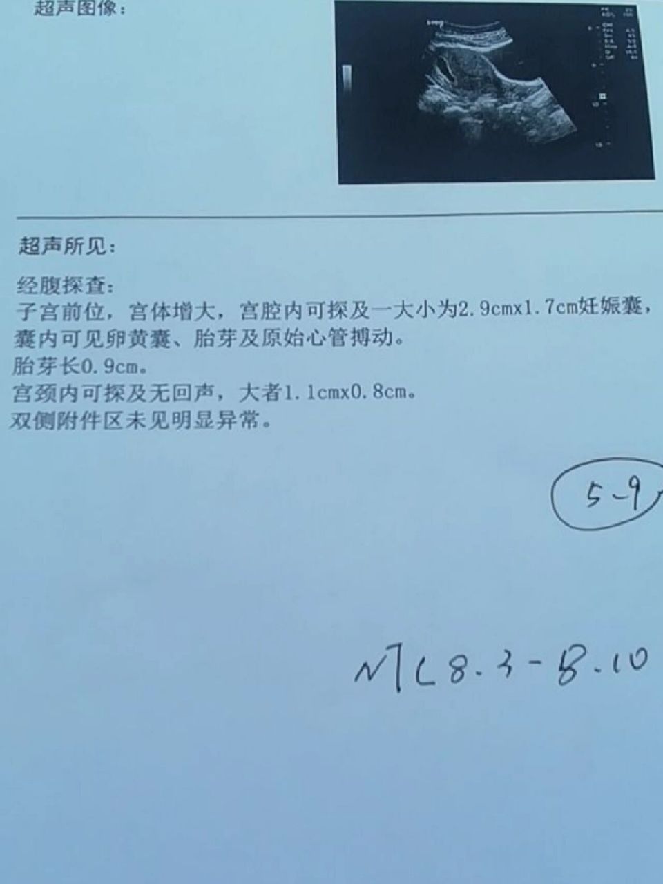从孕囊看男女 请各位大佬帮忙看看孕囊大小能看出来是男孩女孩么