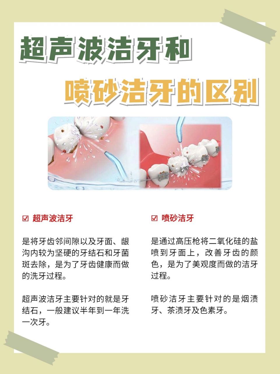 科普丨超声波洁牙和喷砂洁牙有什么区别?