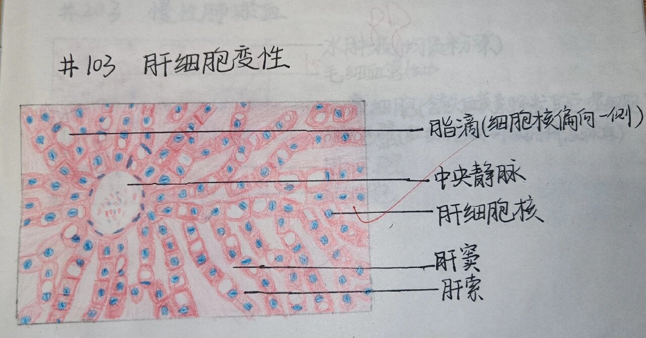 肝细胞脂肪变性# #实验报告# #医学生笔记# #复习资料# #切片#镜贤技