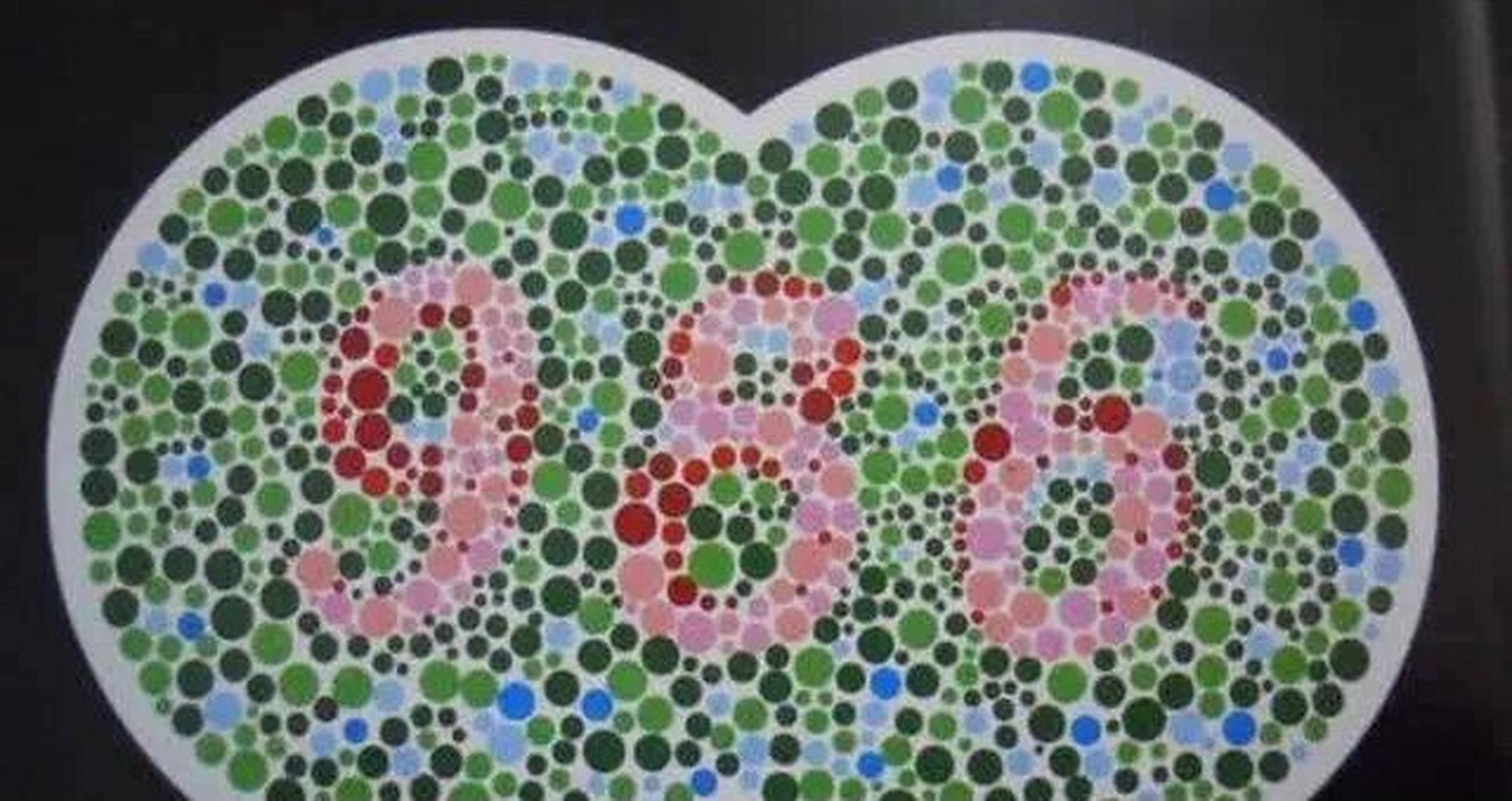 应征入伍大家最关心体检项目