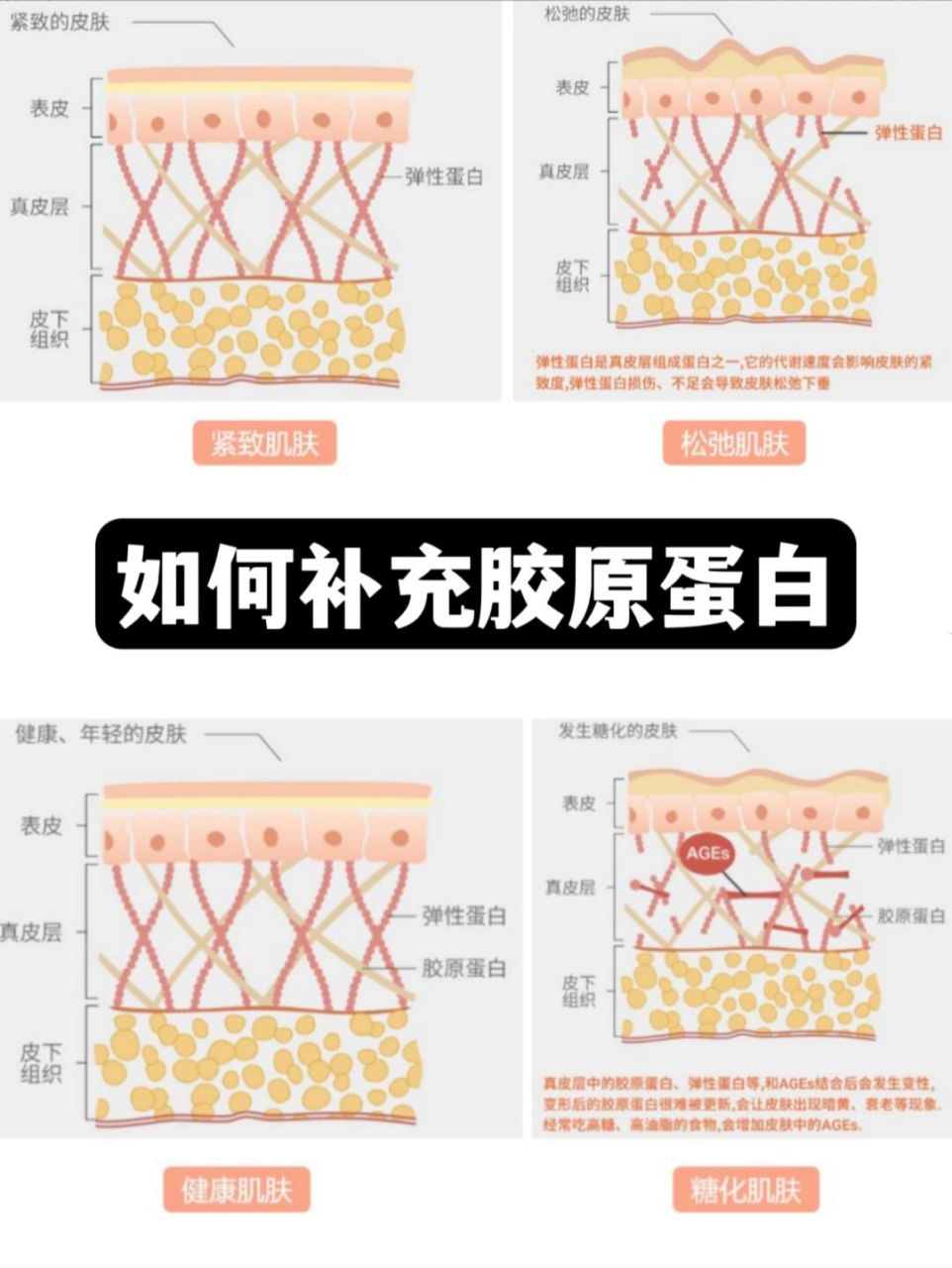 随着年龄的增长,皮肤中富含胶原蛋白的支撑结构(称为真皮)产生变化