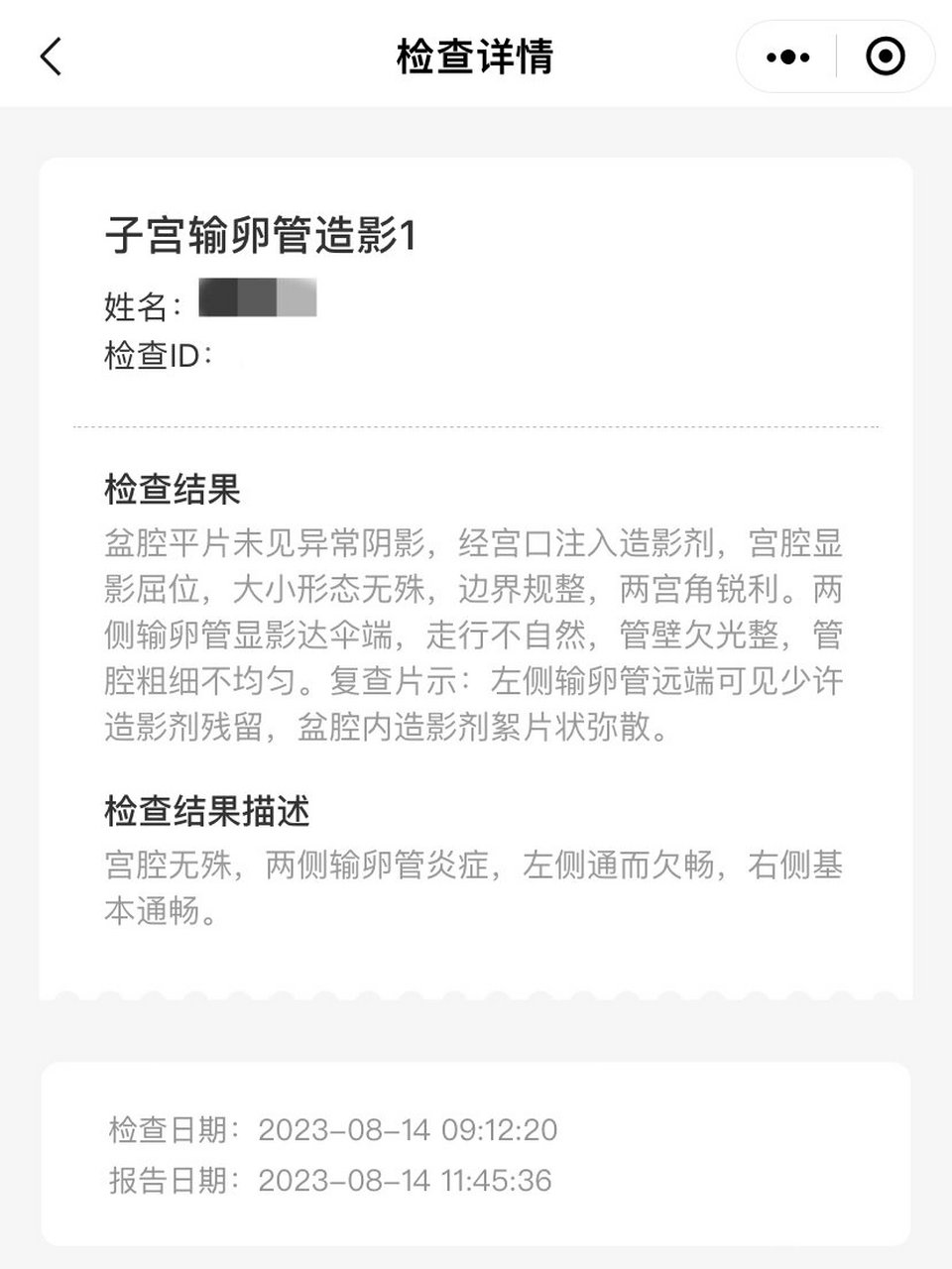 输卵管造影检查事项图片