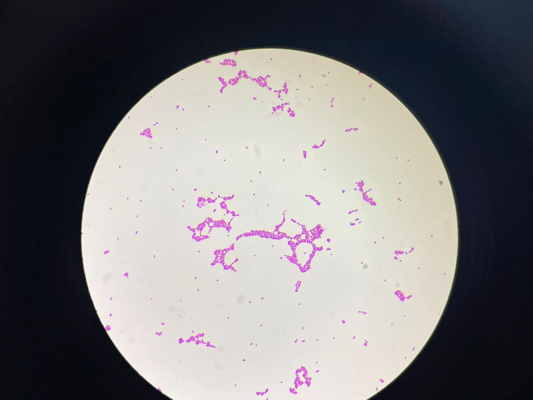 鲍曼不动杆菌 16615形态:革兰阴性球杆菌,大小(1~1.5)μm × (1.