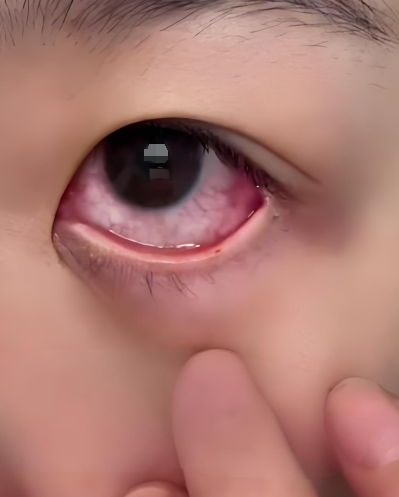 美瞳放久了还能戴吗?