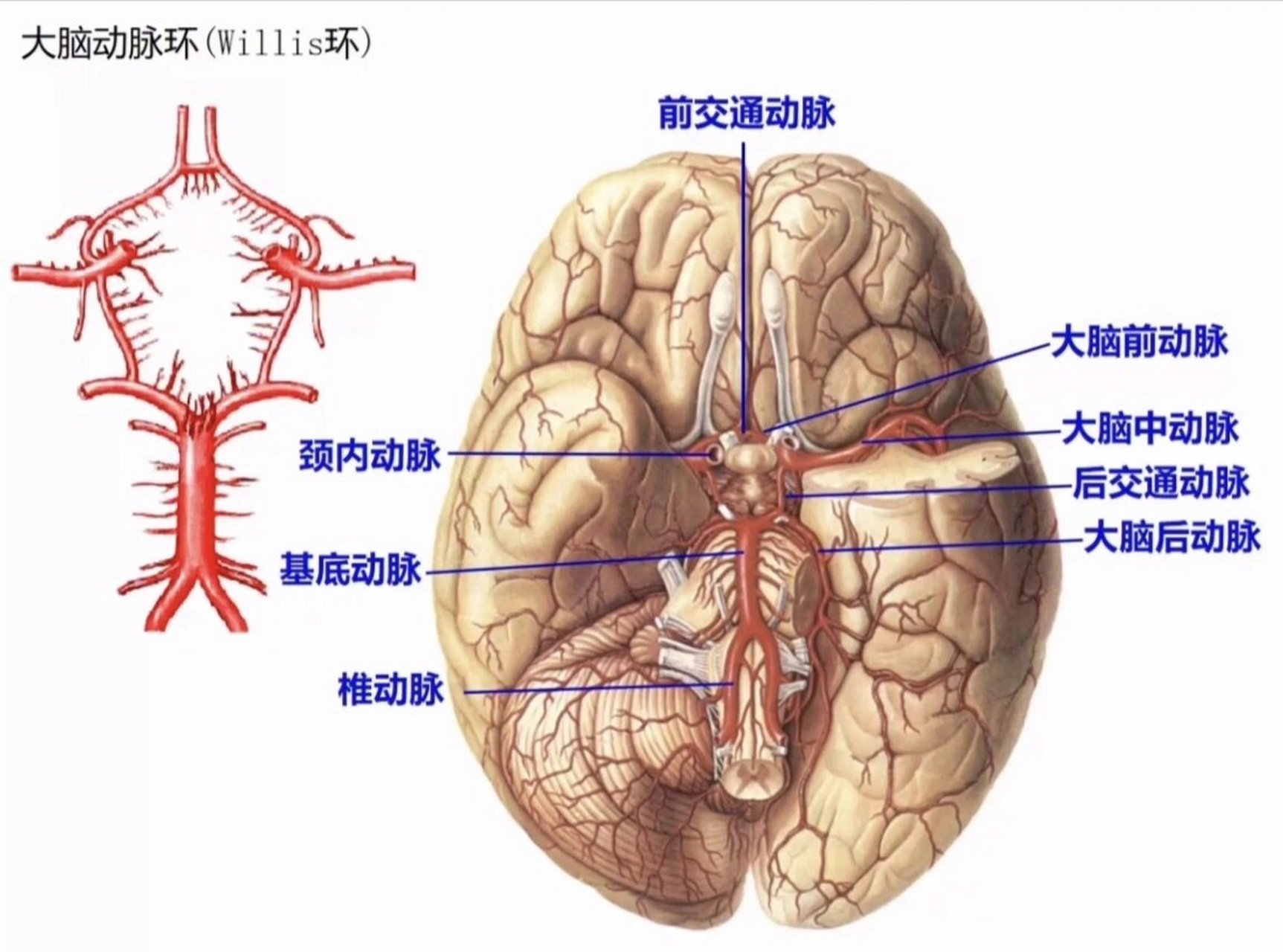 右侧大脑前动脉a1图片