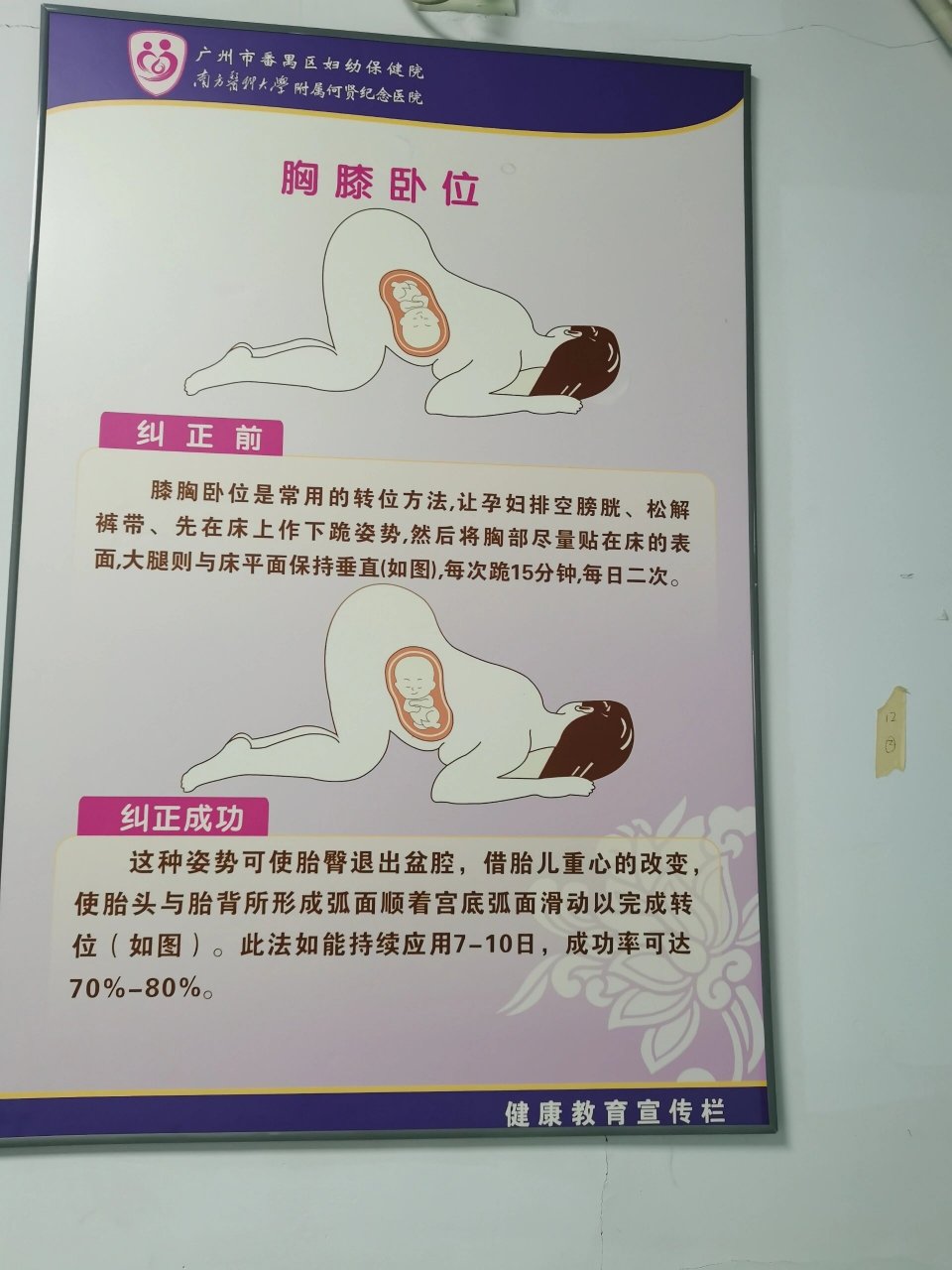 胎位正确姿势图图片