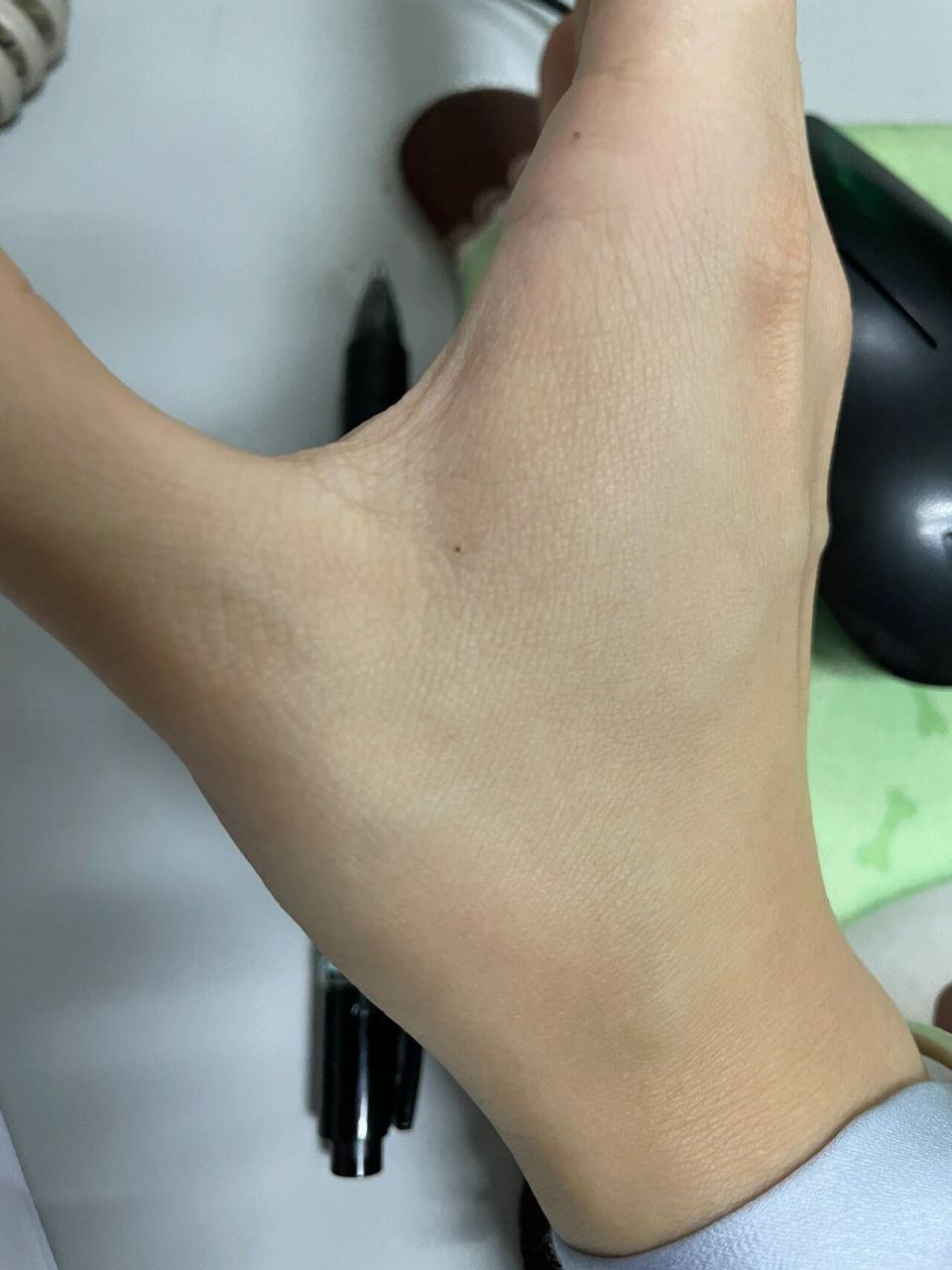 一觉睡醒虎口长了个痣04