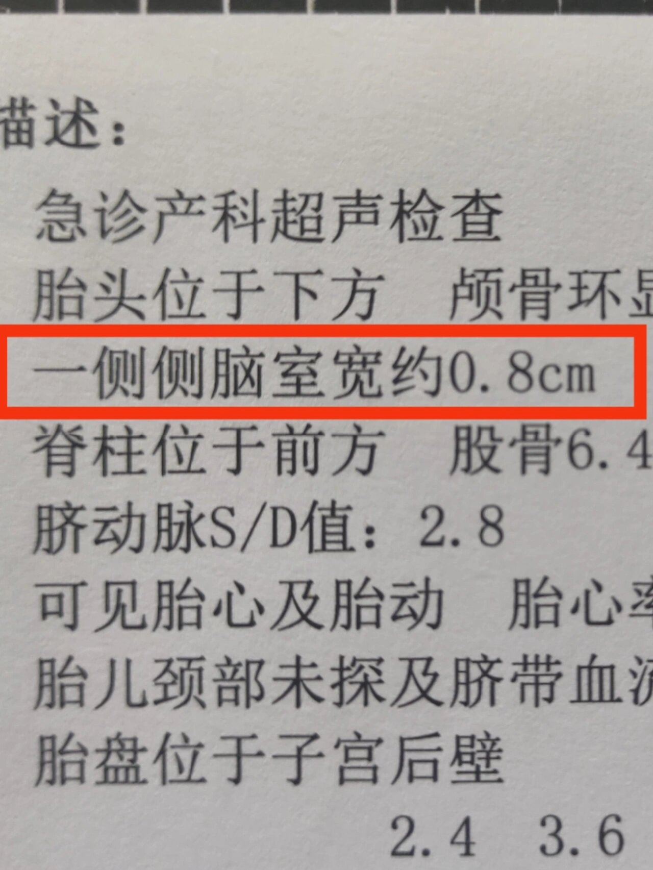 胎儿侧脑室增宽 千万别慌 这些检查做了吗?