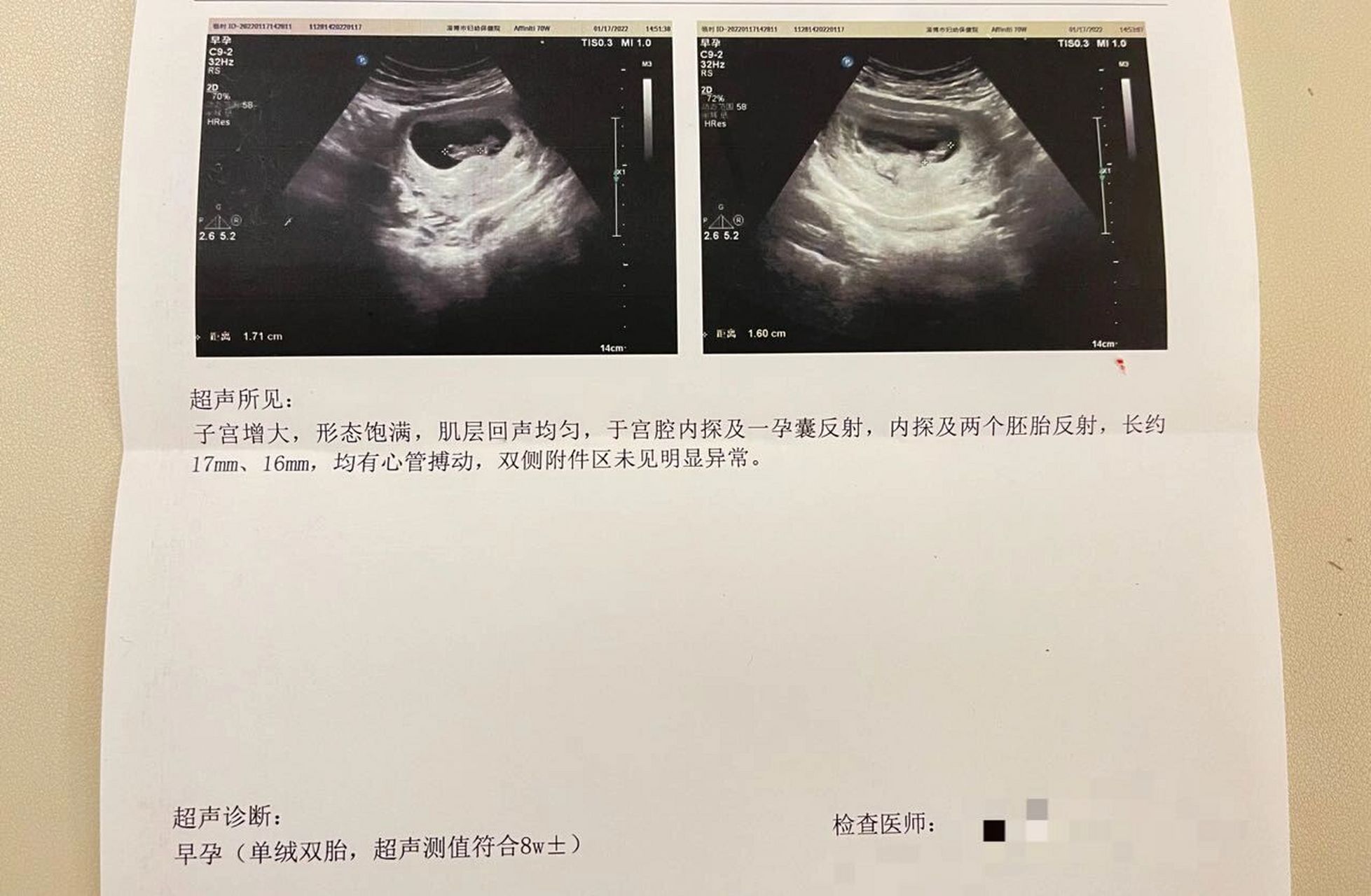怀二宝第一次去做b超,挂的产科普通门诊 医生给开的腹部彩超,后来问