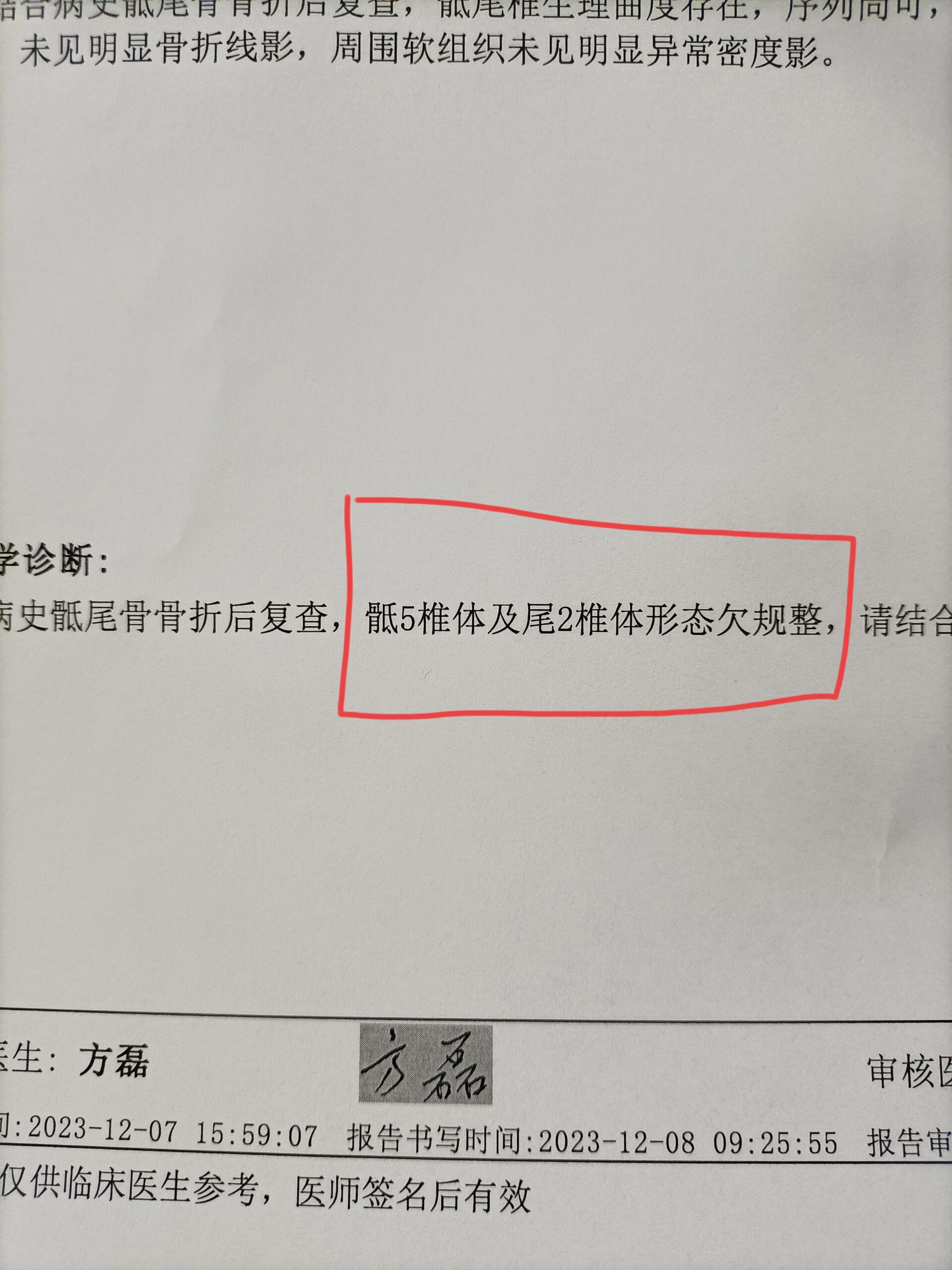 外侧楔骨图片