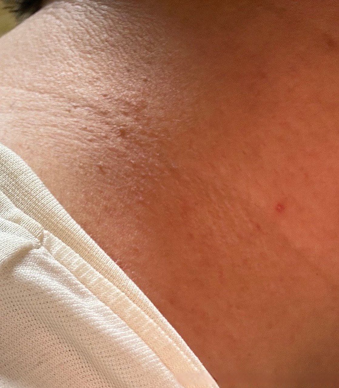 健康美好生活计划# 男性hpv感染脖子上长东西,想知道是不是hpv感染