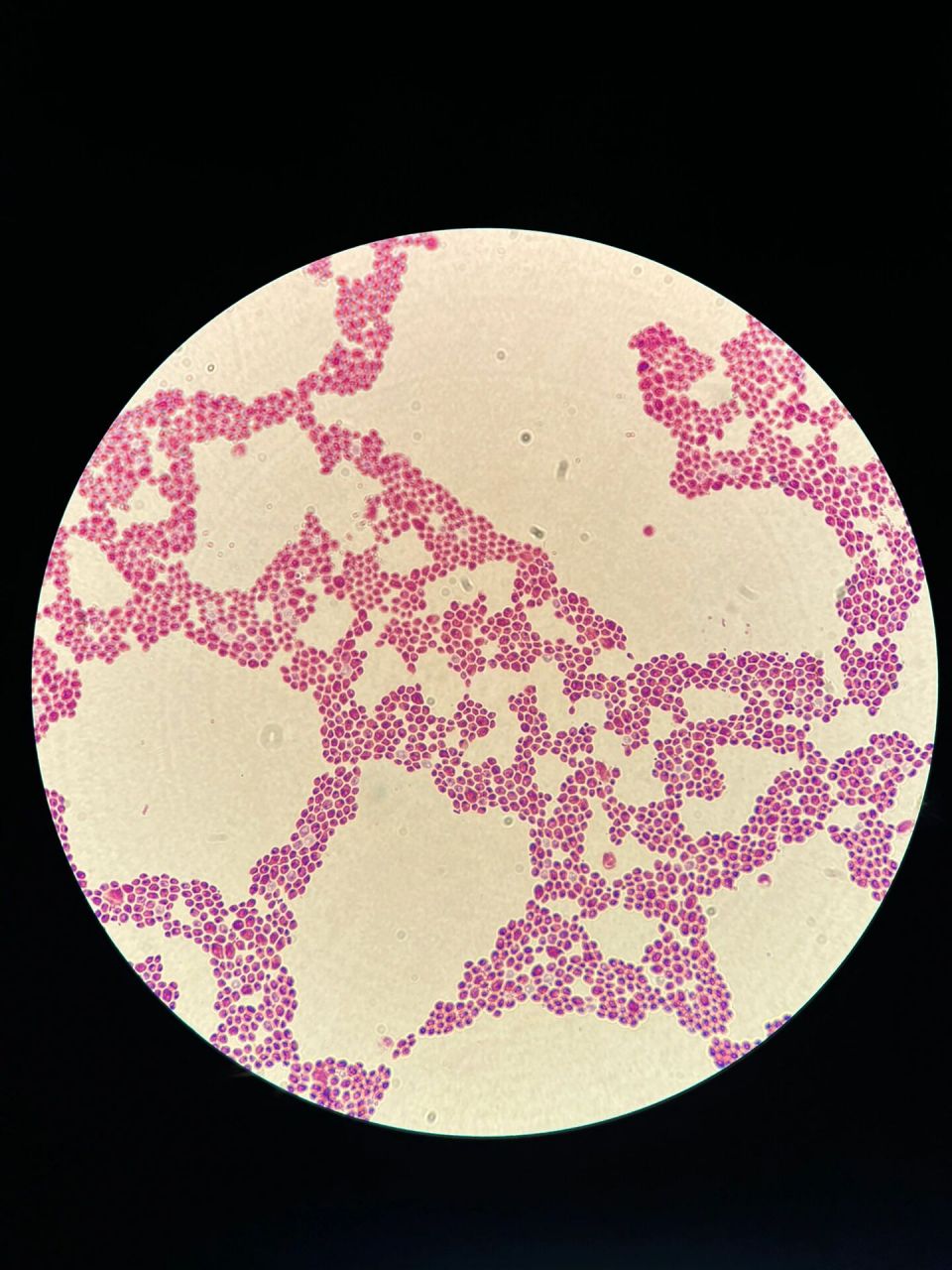 白假丝酵母菌落形态及显微观察 一般我们看到酵母都椭圆形的圆乎乎的