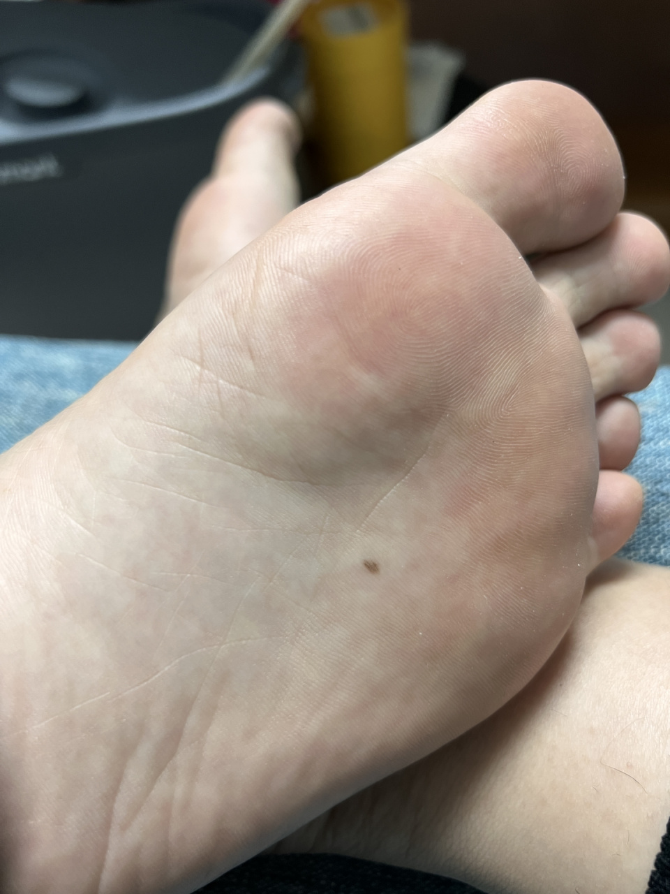 脚底长痣有啥事吗 一个新长的一个一直有 左边脚心不知道啥时候长的