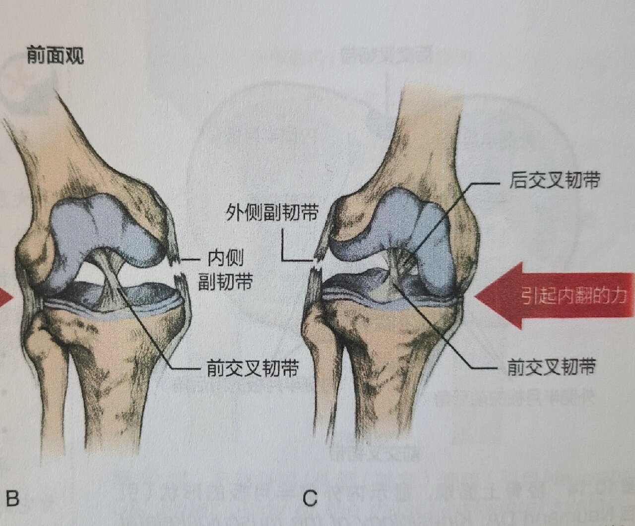 认识外侧副韧带 7815外侧副韧带 又称 腓侧副韧带