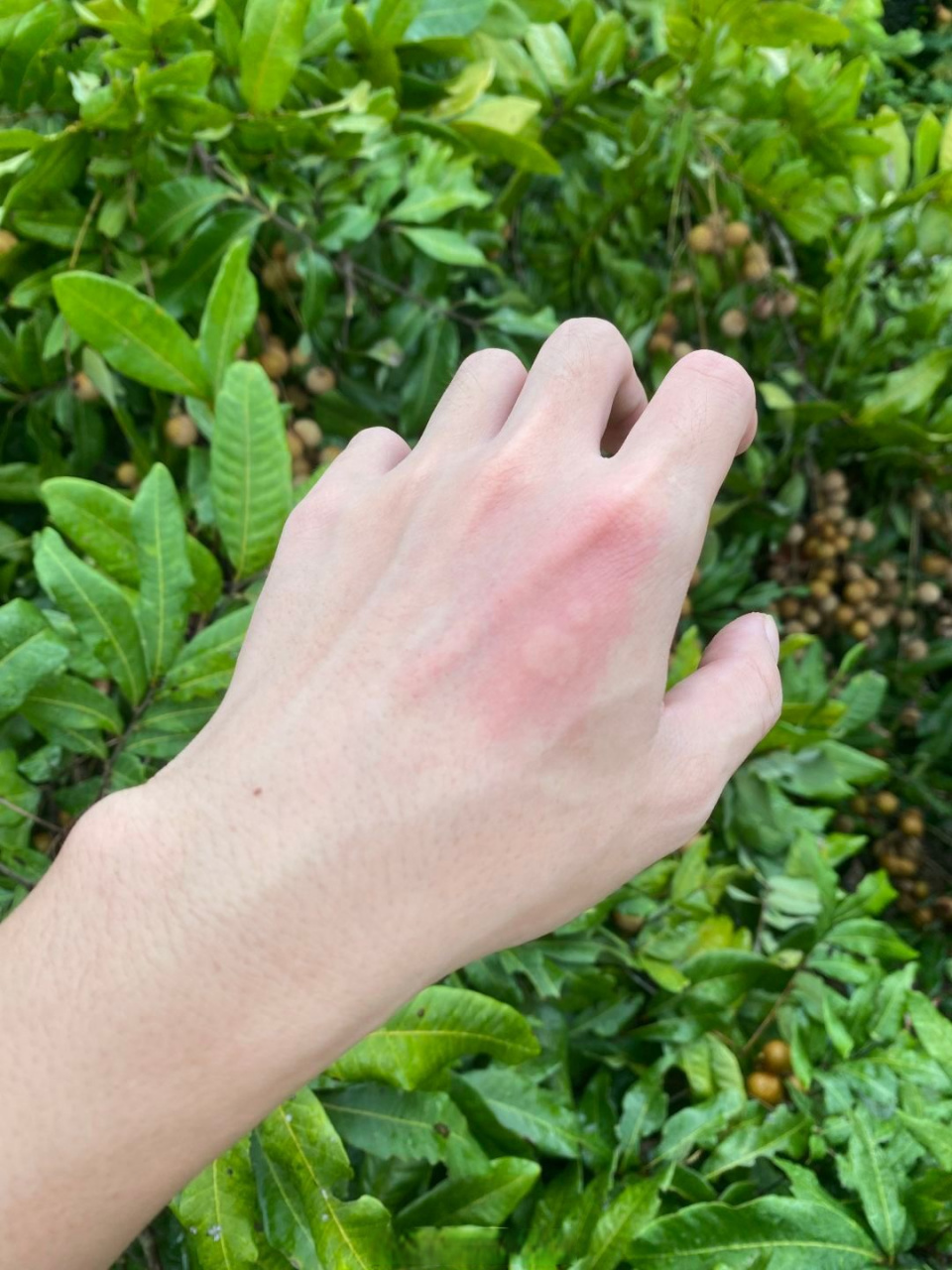 碰到一下像被蜜蜂蛰一样,又辣又痛 ,起个包,这是什么虫子?