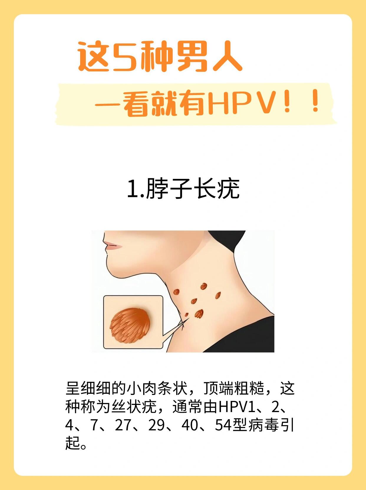 98男人身上这几种情况就有可能是感染了hpv