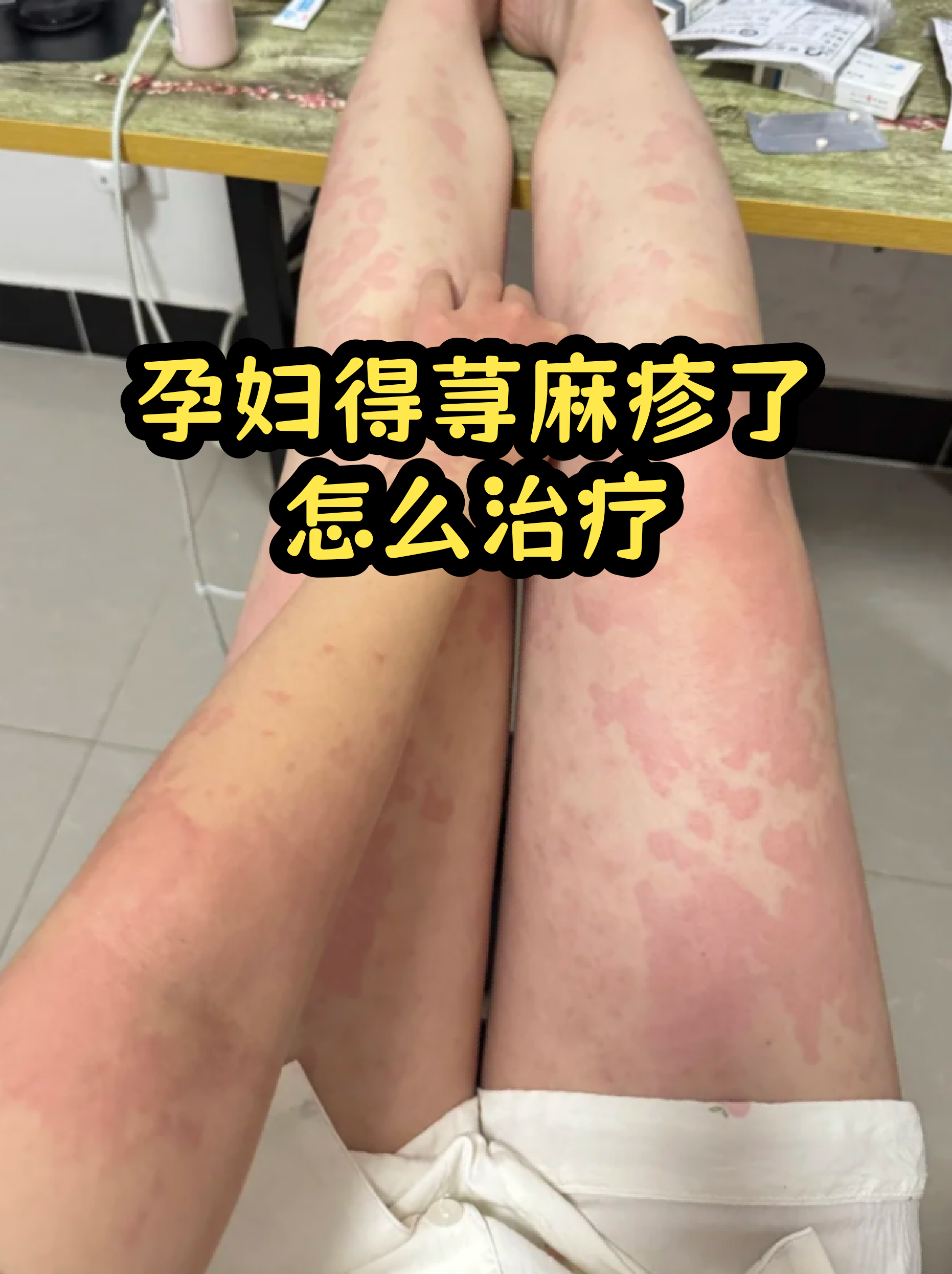包含原武警总医院代诊挂号服务流程-缓解就医焦虑的词条