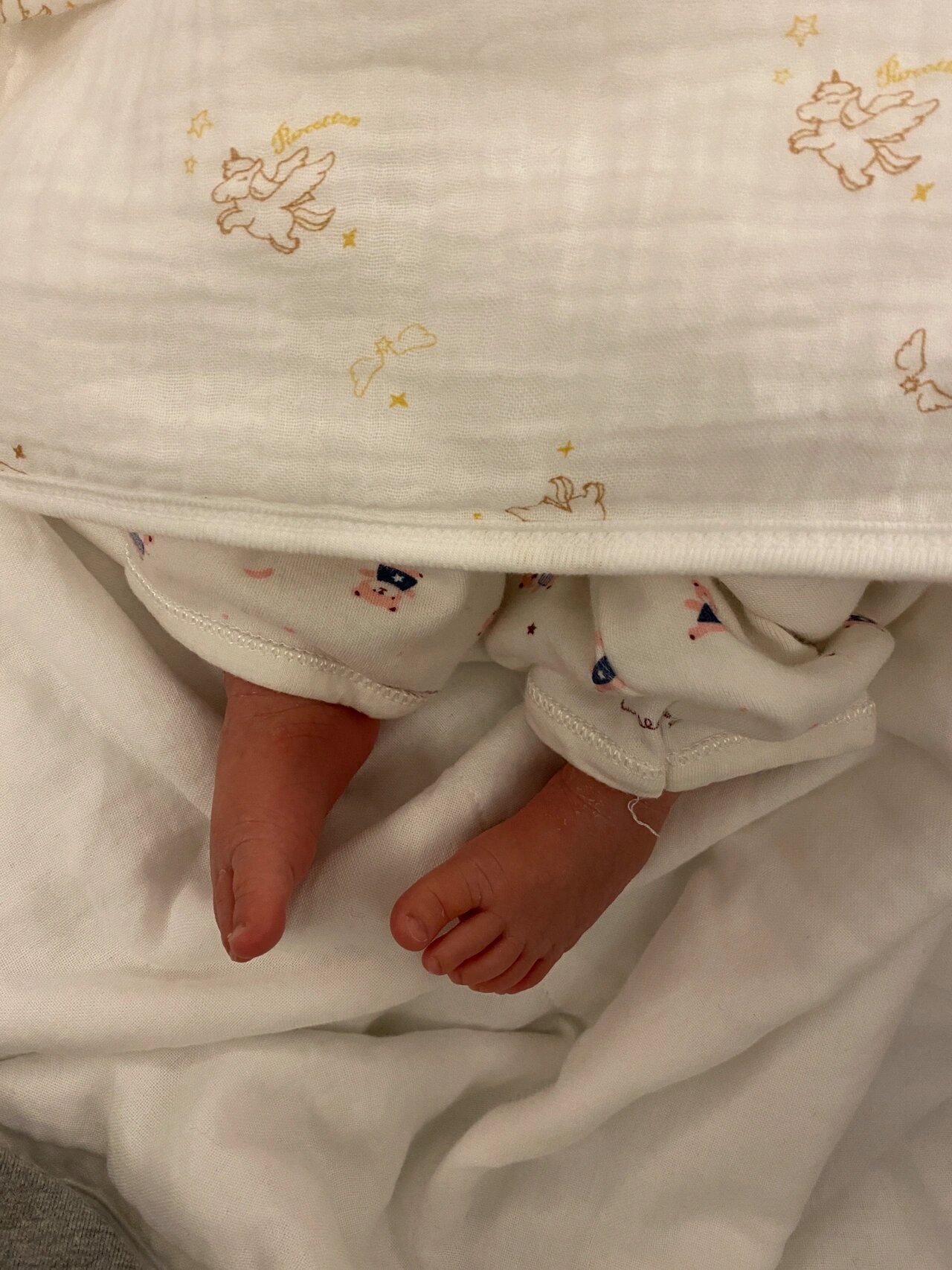 孕期双足内翻终于出了好结果,传好运 在孕期的时候查出宝宝是双足内翻