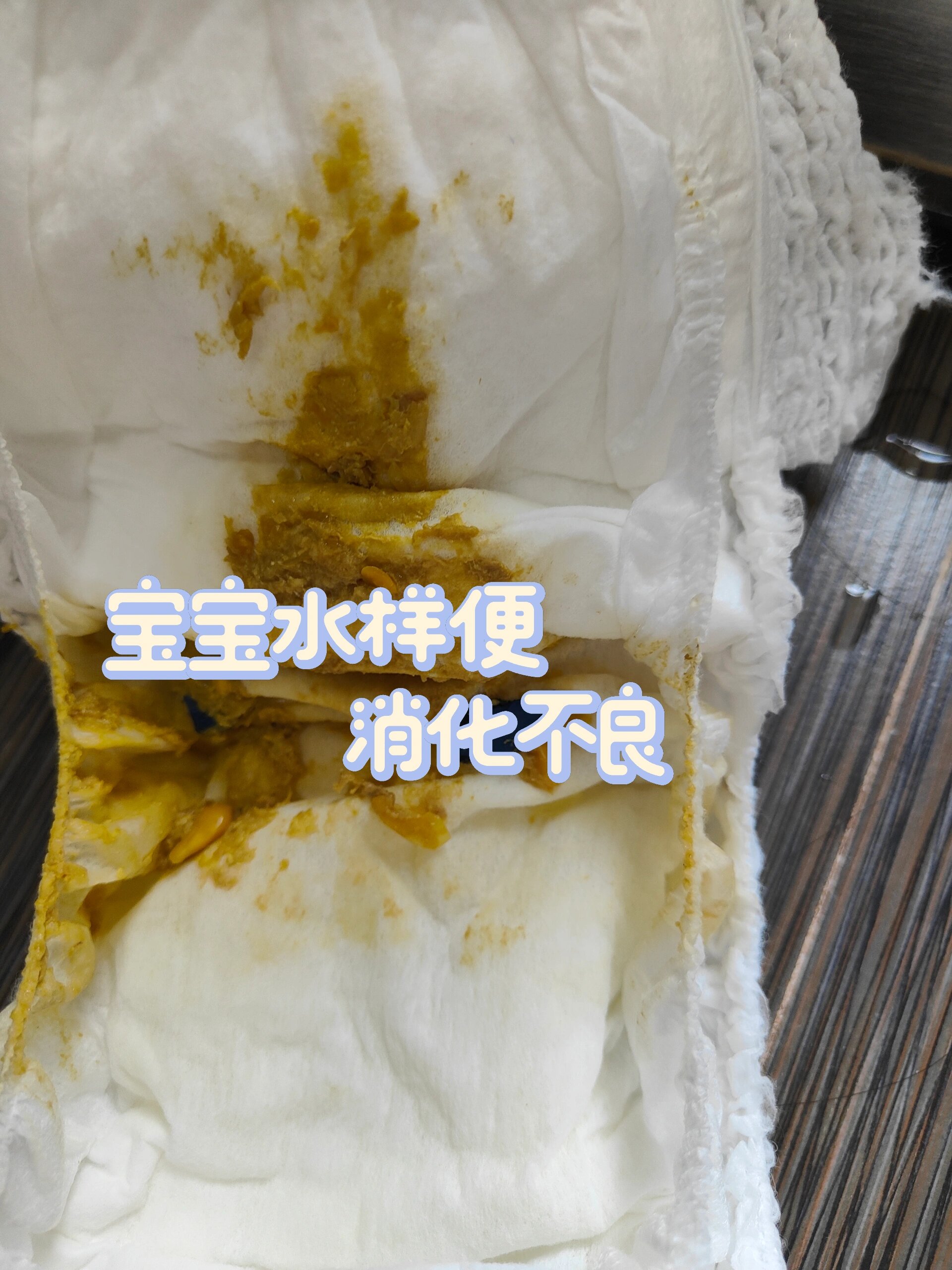 宝宝消化不良,水样便急救办法来啦