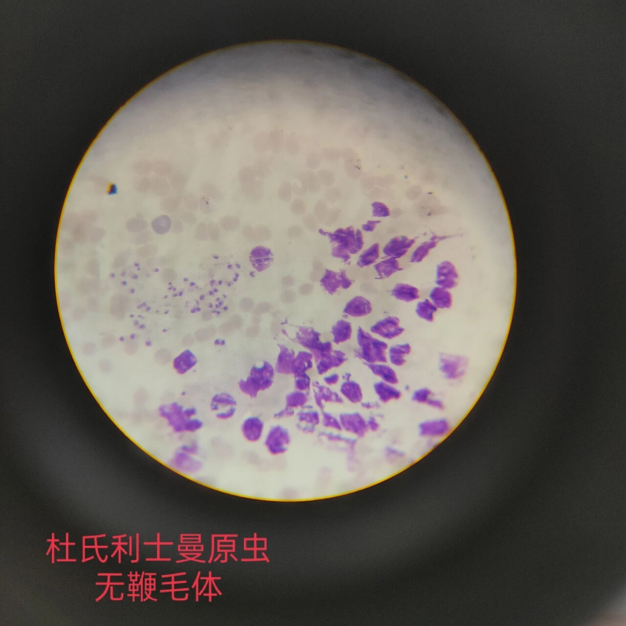 医学原虫镜下观察 ①溶组织内阿米巴包囊 (感染期为四核包囊,二分裂)