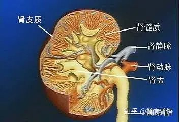 海绵肾是什么