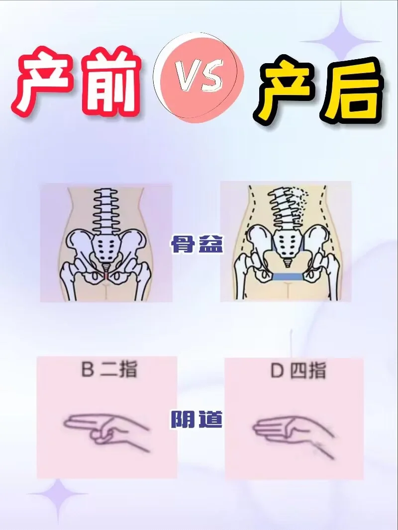 骨盆扩张 怀孕期间,胎儿生长发育需要足够的空间,骨盆会逐渐扩张,到