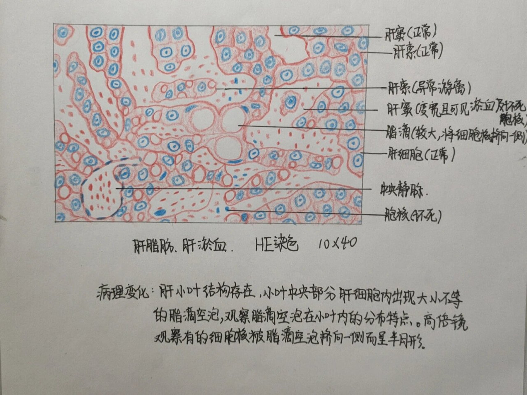 病理学实验-肝淤血 这是看上另一个友友的图画的,是肝脂肪 肝淤血绘图