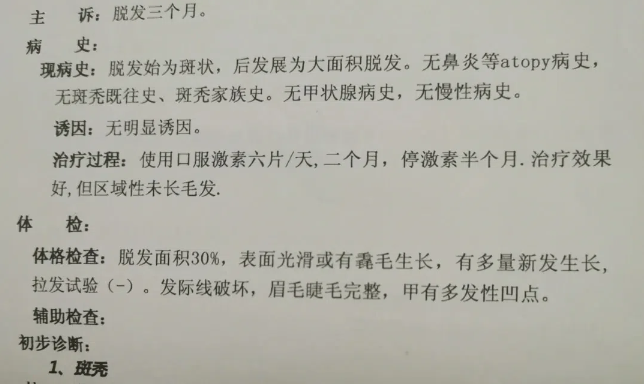 为什么头发会掉