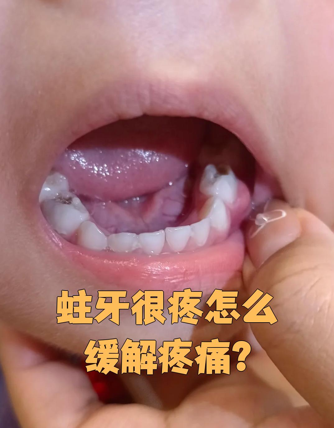 如果疼得受不了,最好尽快去医院检查治疗