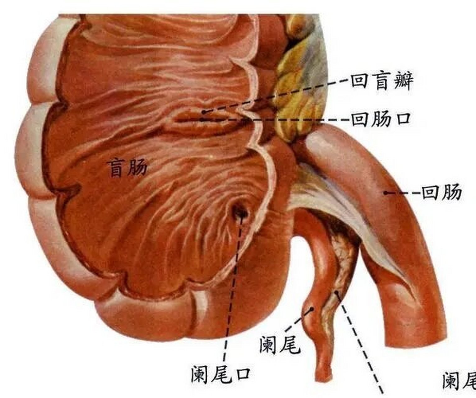 回盲瓣解剖位置图片