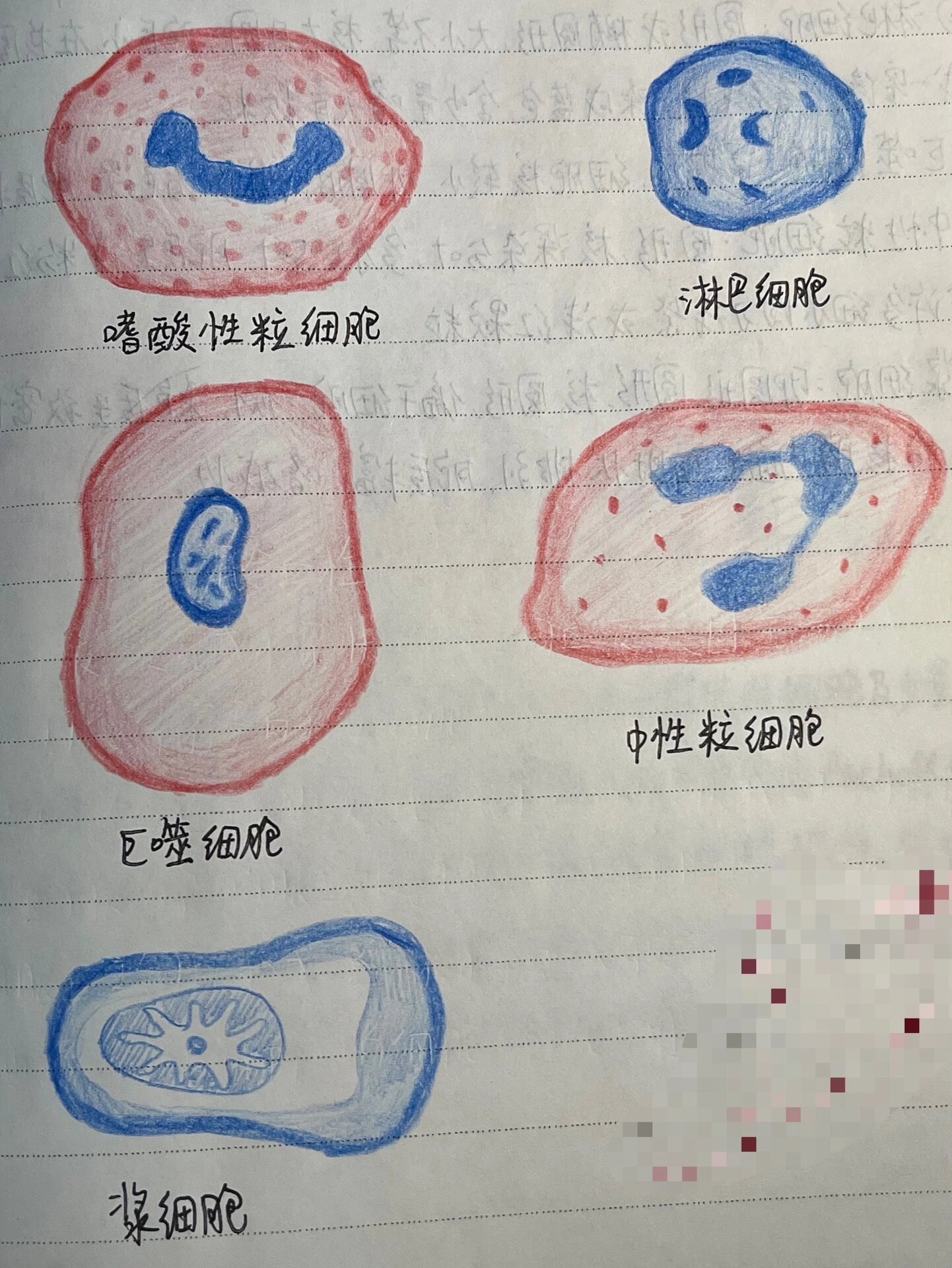 病理切片红蓝铅笔✏️图 1⃣️风湿小体 2⃣️炎细胞 3