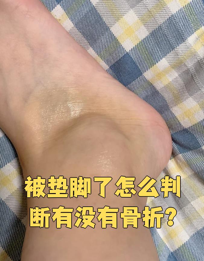 被垫脚后想判断有没有骨折,主要看两点:症状和检查
