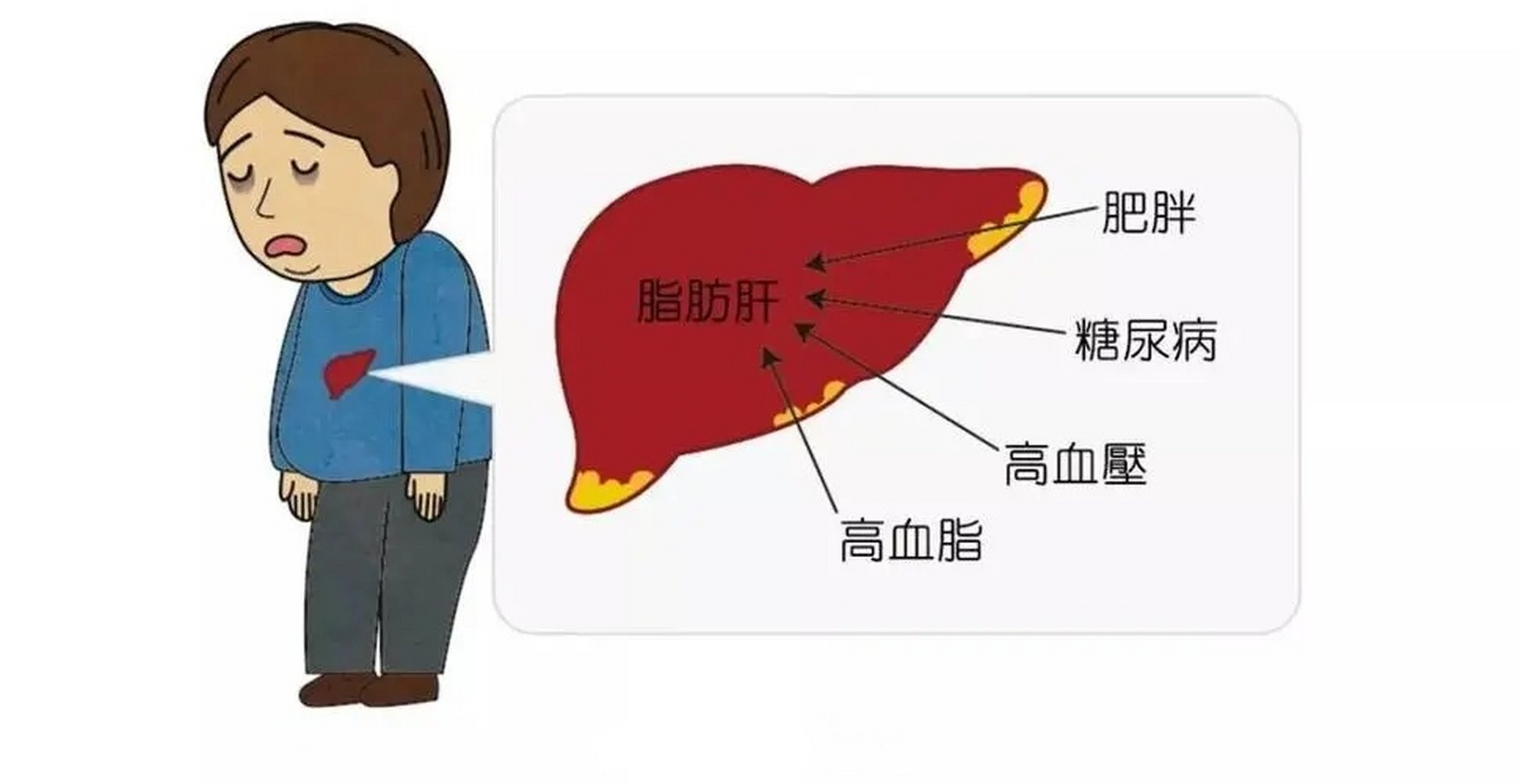 脂肪肝位置图图片