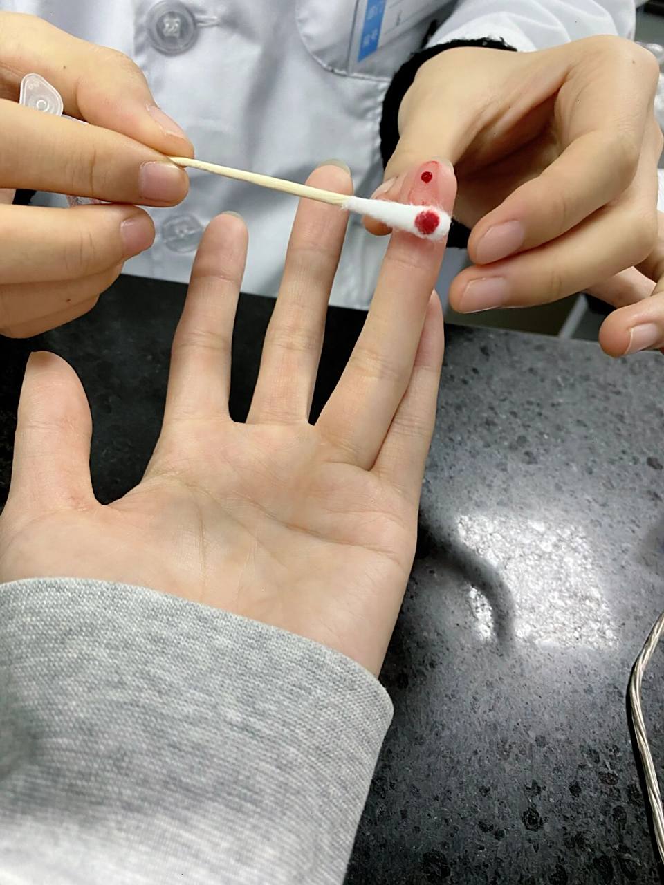 护士提醒我手指抽血比静脉疼.