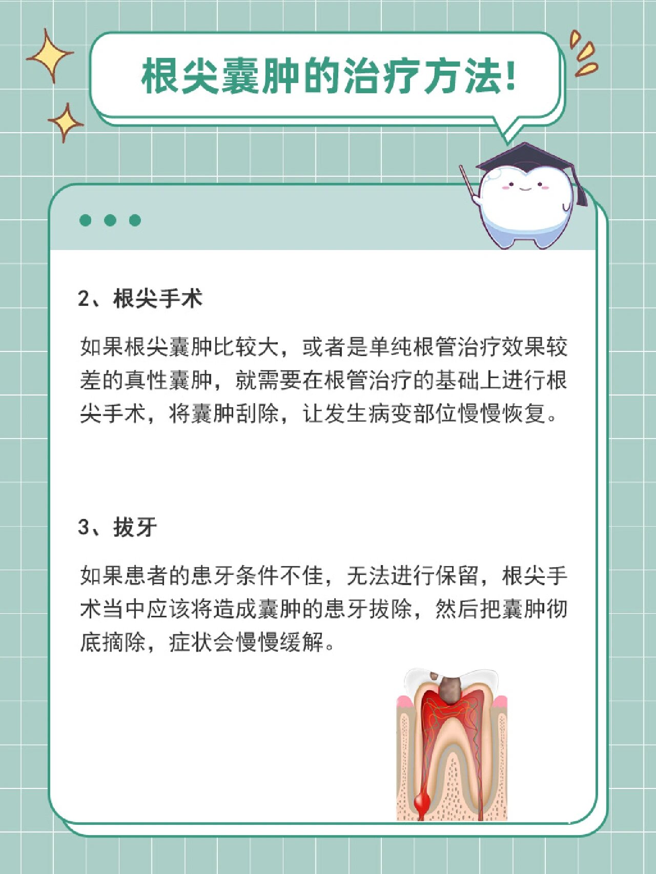 根尖囊肿的治疗方法有哪些71 1,根管治疗 当根尖囊肿非常小,直径不