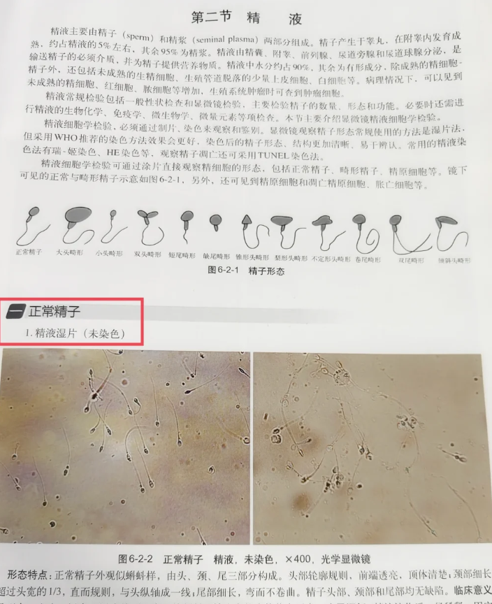 为什么精子自己流出来