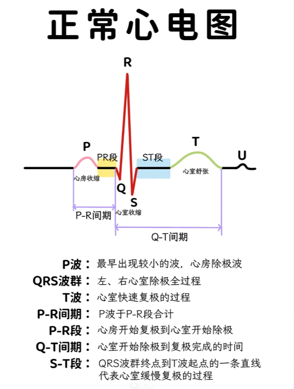 心电图上的qrs波代表心室除极的过程.先看看心电图是怎么工作的