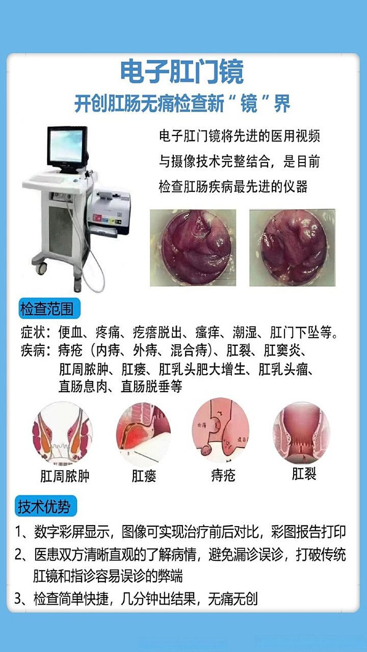 柳州东大肛肠医院# 电子肛门镜 针对下消化道检查该系统彻底改变了